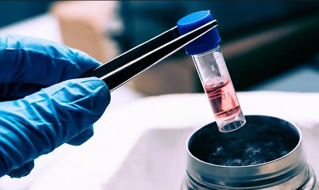 DEMUESTRAN EFECTIVIDAD DE CÉLULAS TRONCALES DE SANGRE DE CORDÓN UMBILICAL PARA TRATAR LABIO Y PALADAR HENDIDO EN BEBÉS.