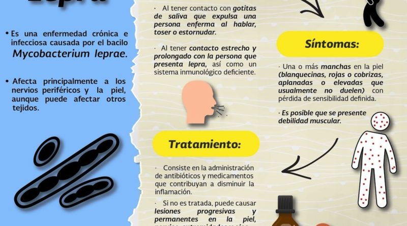HAY LEPRA EN JALISCO, EN CUATRO DE LOS 21 MUNICIPIOS DETECTADOS SUPERAN LÍMITES DE LA OMS.
